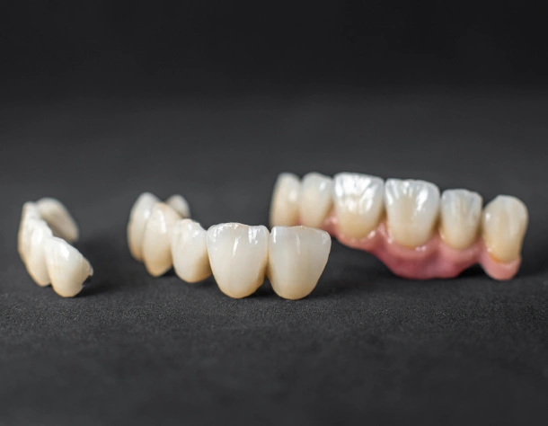 Porcelain Crowns In Panorama City CA